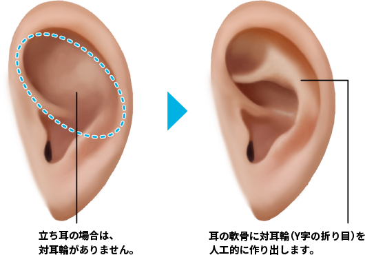 ear_method