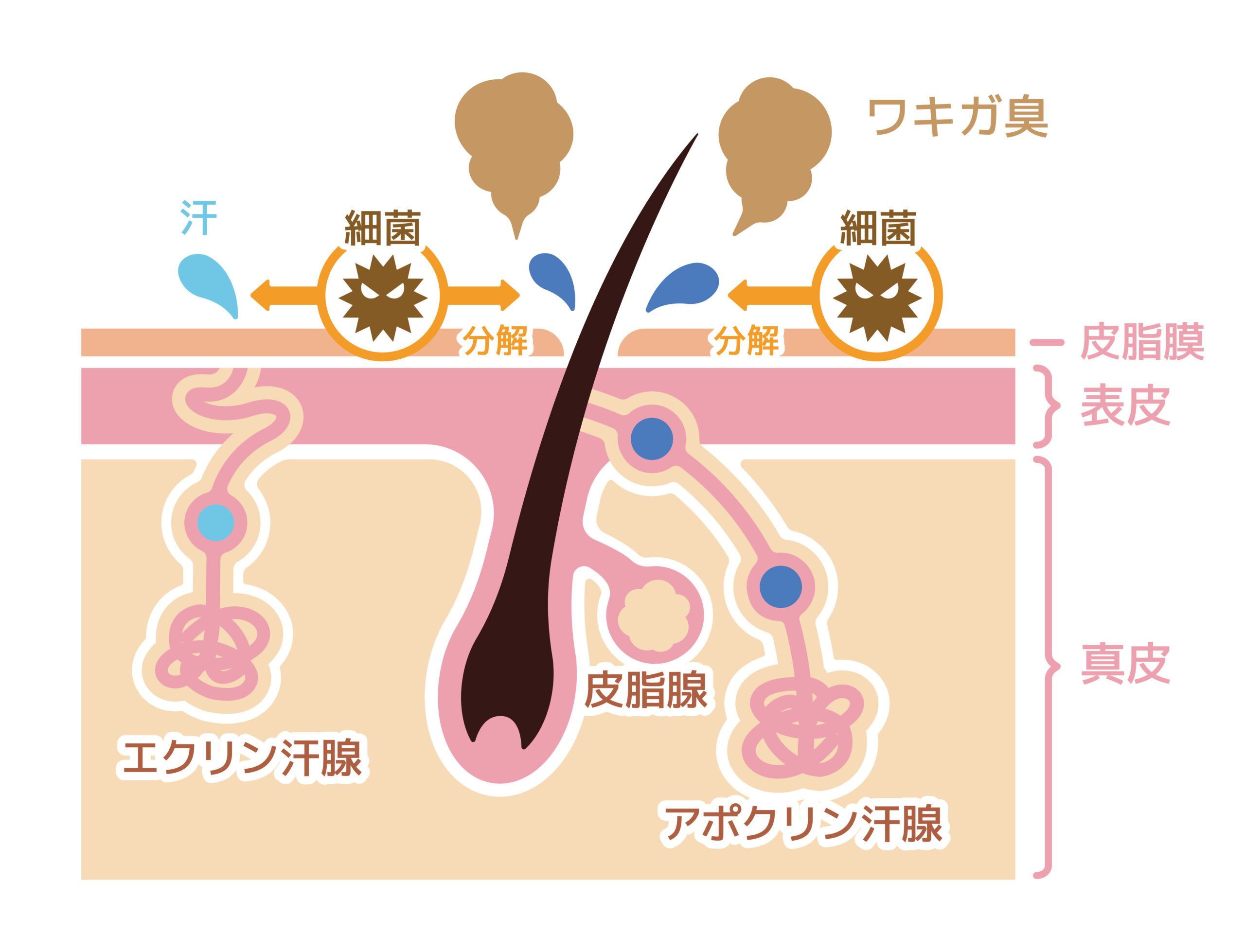 Cause,Of,Body,Odor,Illustration,(japanese,/,No,Explanation,Text).