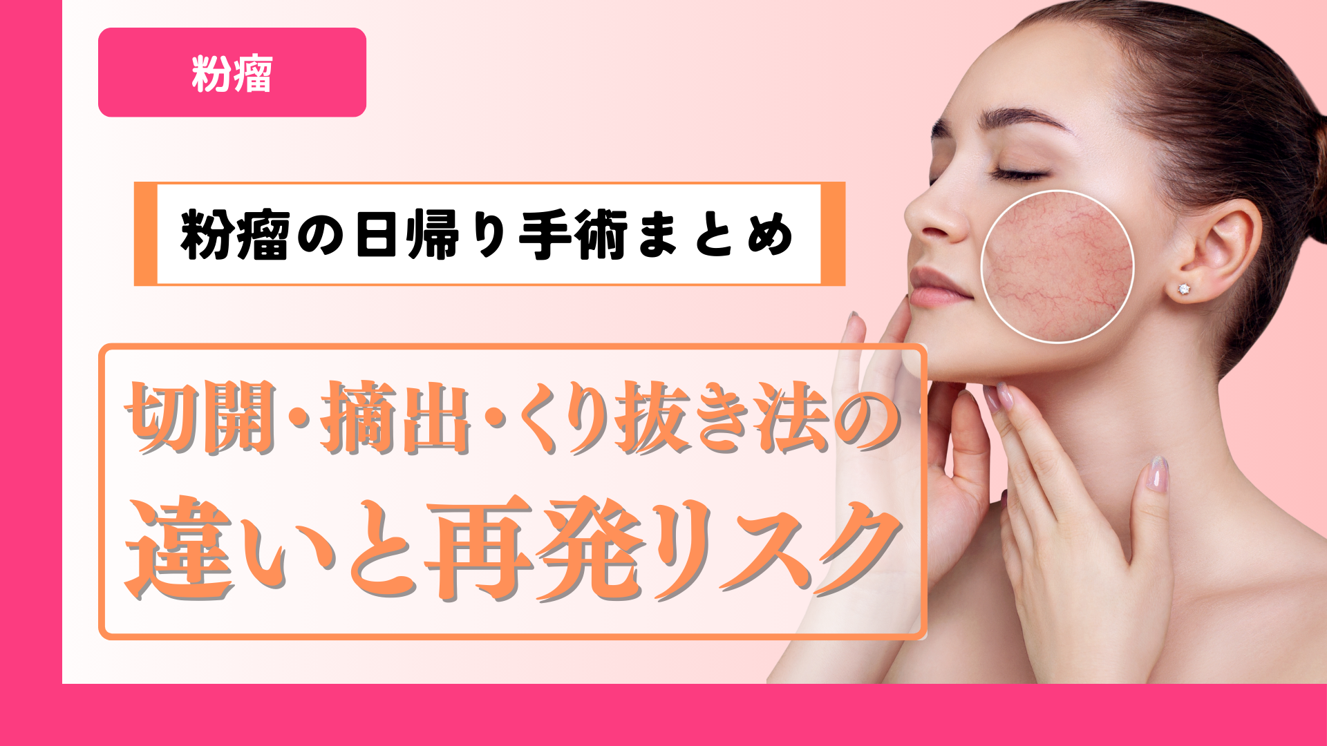 ワキガ治療って何回通うの？治療法別の通院回数とスケジュールまとめ