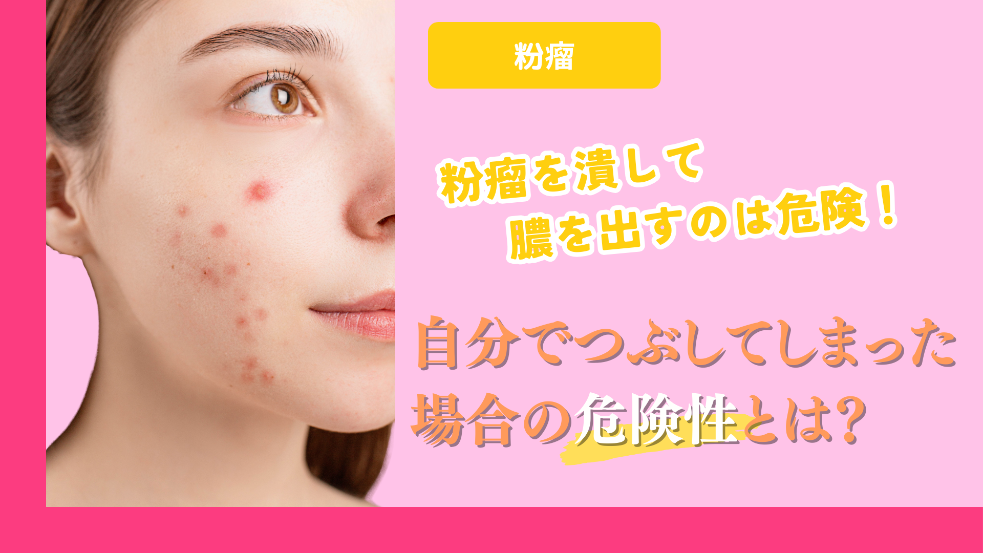 男性にも人気のクマ取り治療｜第一印象アップを目指すメンズ美容の新常識とは？