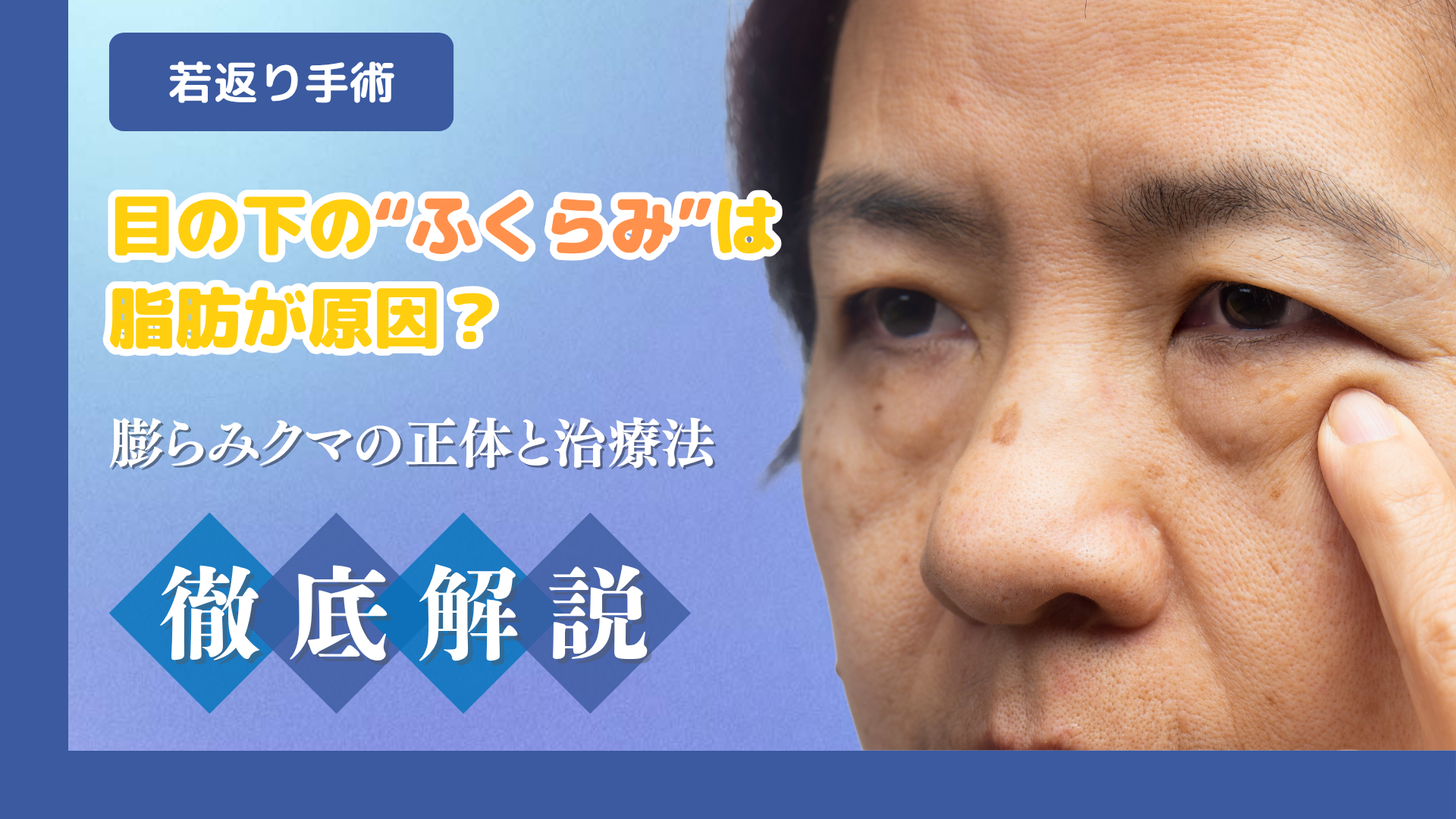 目の下の“ふくらみ”は脂肪が原因？膨らみクマの正体と治療法を徹底解説