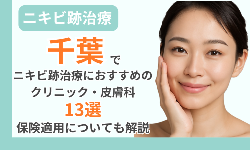 ニキビ跡治療 千葉