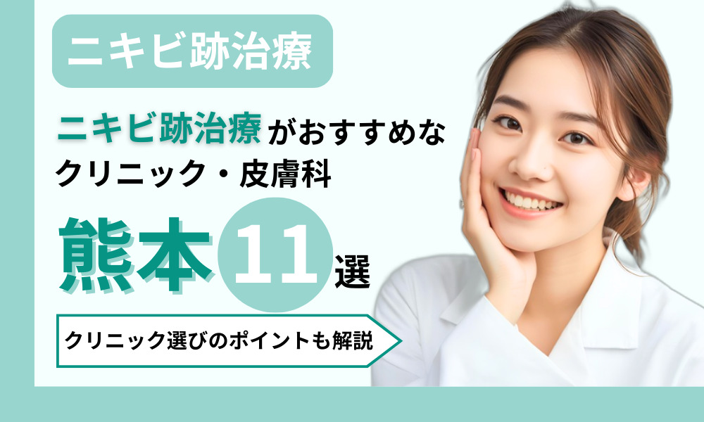 ニキビ跡治療 熊本