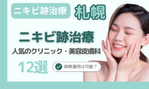 ニキビ跡治療 札幌