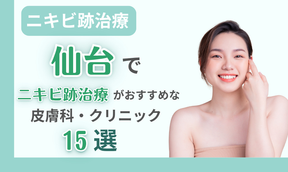 ニキビ跡治療 仙台
