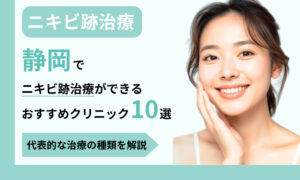 ニキビ跡治療 静岡